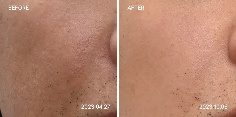 Pigment Contactor – after