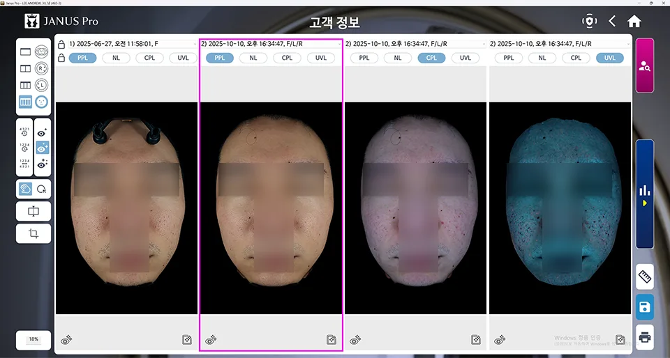회복새살침 4회 | 캐비어 리빌더 4회