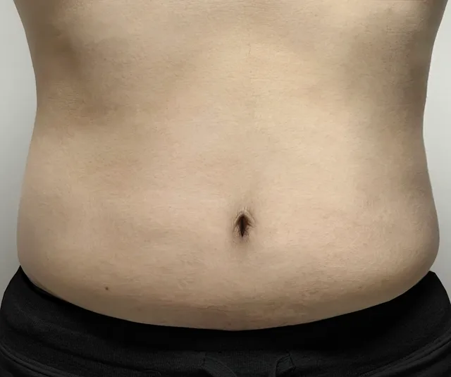 -4.7kg 4주차 81.1kg