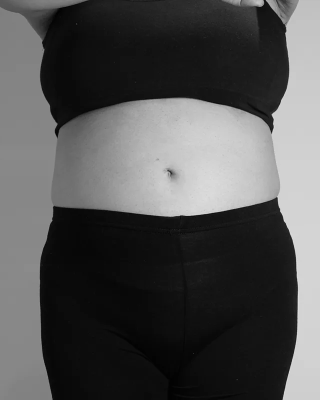 감량비책 진 Basic 30대 여성 162.6cm 80.5kg