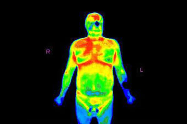 적외선 체열 검사