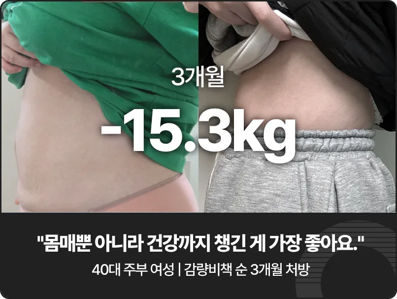 형인재 다이어트 전후 비교 2